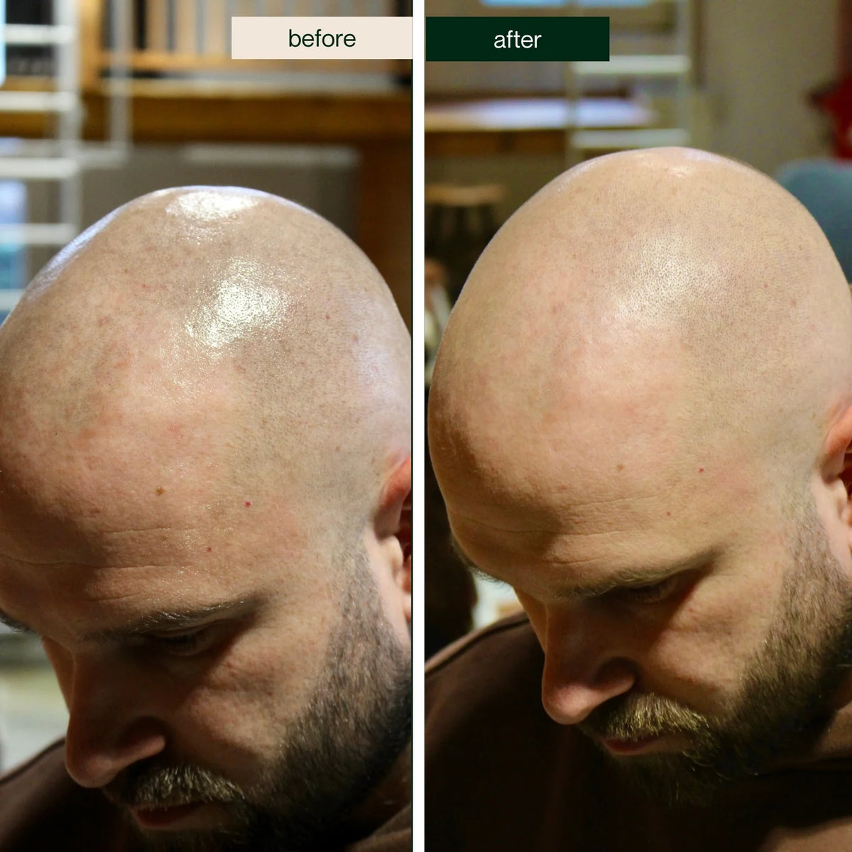 Better Be Bold Bald Cream met Anti-Shine Effect – 50 ml